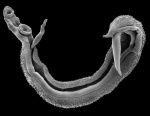 Schistosoma.jpg